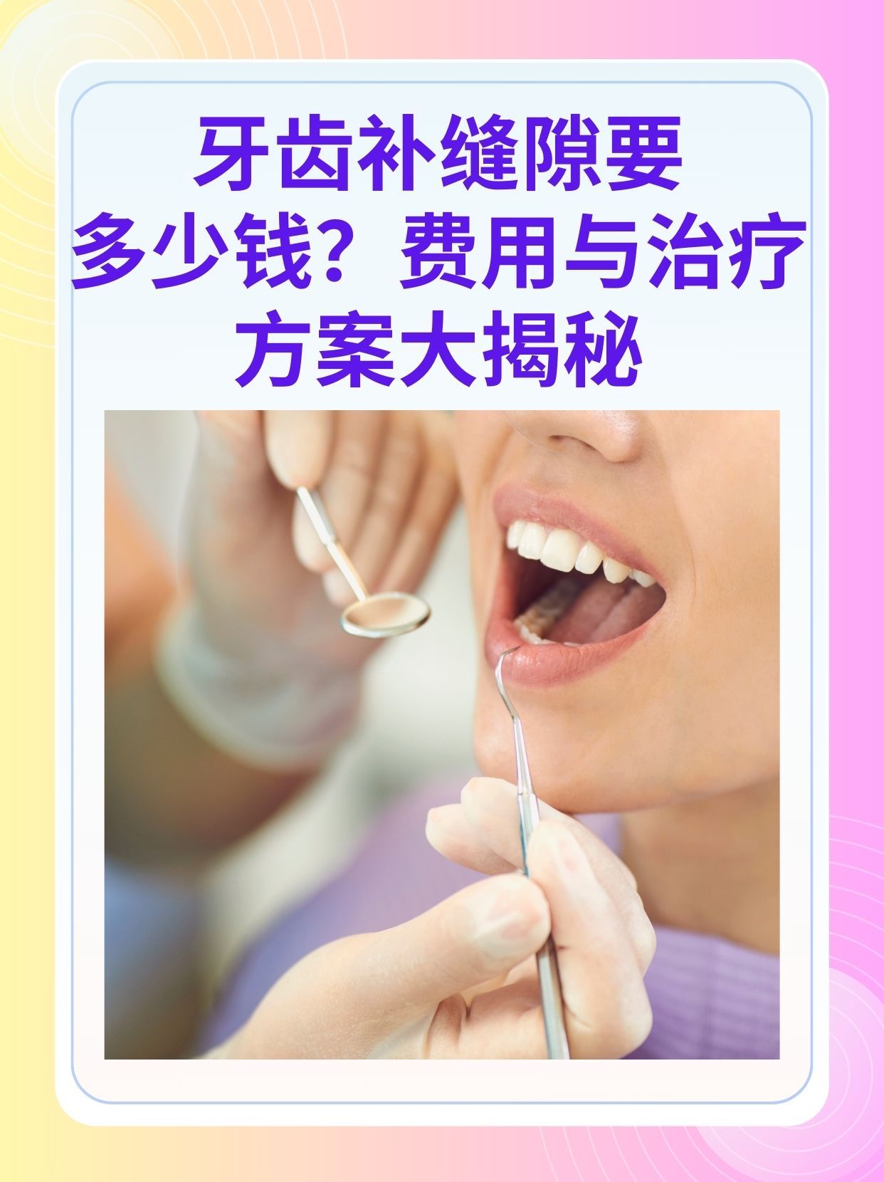 榆林补牙医保可以报销吗(补牙医保可以报销吗 哪些可以报销呢)